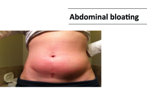  Abdominal bloating