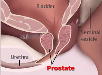 Ar Prostate Cancer Surgeons India