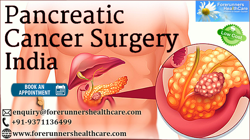 Pancreatic Cancer Treatment in India