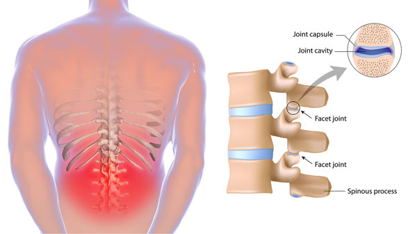 Back ache surgery with top hospitals in Chennai