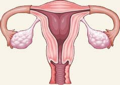 causes of fibroid