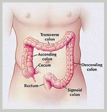 Colon Cancer Surgery in India