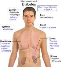 Low Cost Diabetes Surgery in India.