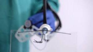 Minimal Invasive Surgery in India