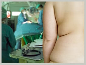 low cost roux-en-y surgery, roux-en-y surgery low cost India, benefits roux-en-y surgery